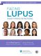 Facing Lupus · A Guide for Patients and Their Families