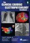 The Clinical Cardiac Electrophysiology Handbook