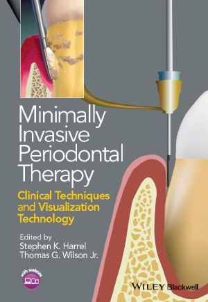 Minimally Invasive Periodontal Therapy, Clinical Techniques and Visualization Technology