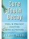 Cure Tooth Decay · Heal and Prevent Cavities With Nutrition - Limit and Avoid Dental Surgery and Fluoride · 2nd Edition