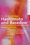 Hashimoto und Basedow