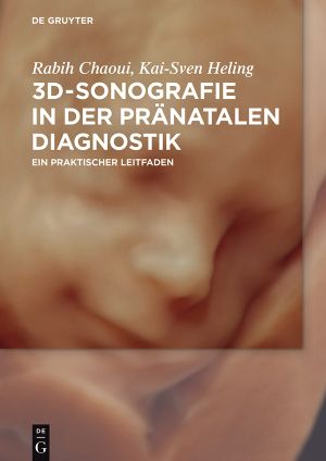 3D-Sonografie in der pränatalen Diagnostik · Ein praktischer Leitfaden