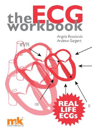 The ECG Workbook