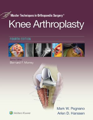Master Techniques in Orthopaedic Surgery · Knee Arthroplasty · 4th Edition