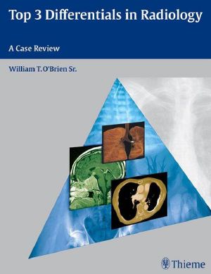 Top 3 Differentials in Radiology: A Case Review